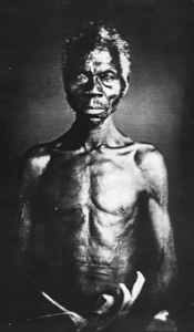 Faces Of Slavery: White Sciences Attempt To Prove That Africans Were Biologically Inferior